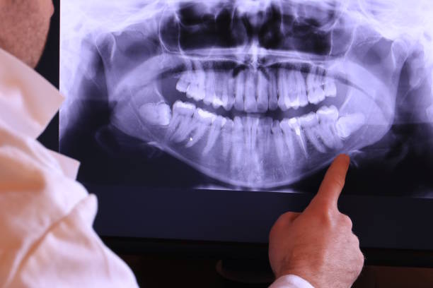 Best Emergency Dental Care for Broken or Chipped Teeth in Metuchen, NJ